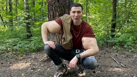 Кириллу Терёшину, известному трэш-блогеру, может потребоваться ампутация рук из-за ухудшения состояния тканей